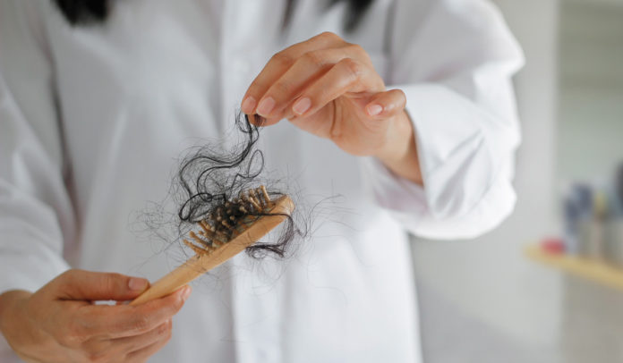 Випадіння волосся