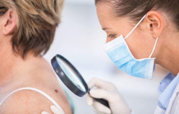 Небезпечні родимки