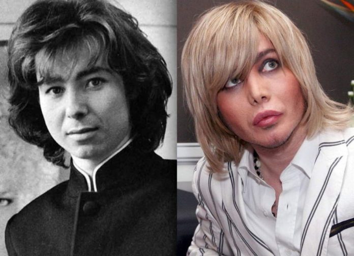 Сергій Зверєв: до та після пластики