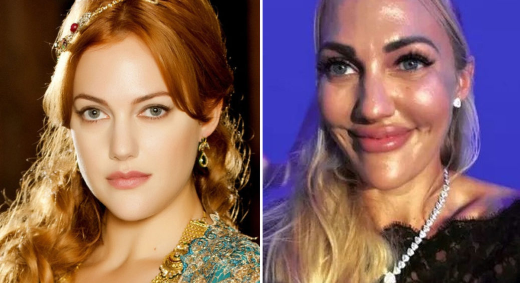 З красуні в чудовисько: як Мер’єм Узерлі, яка зіграла роль Хюррем Султан, змінилася після пластики 