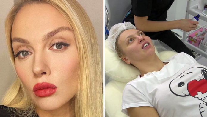 Оля Полякова розповіла про пластику та уколи краси