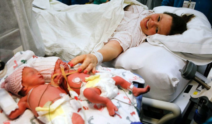 Близнята, які народилися, тримаючи одна одну за руки