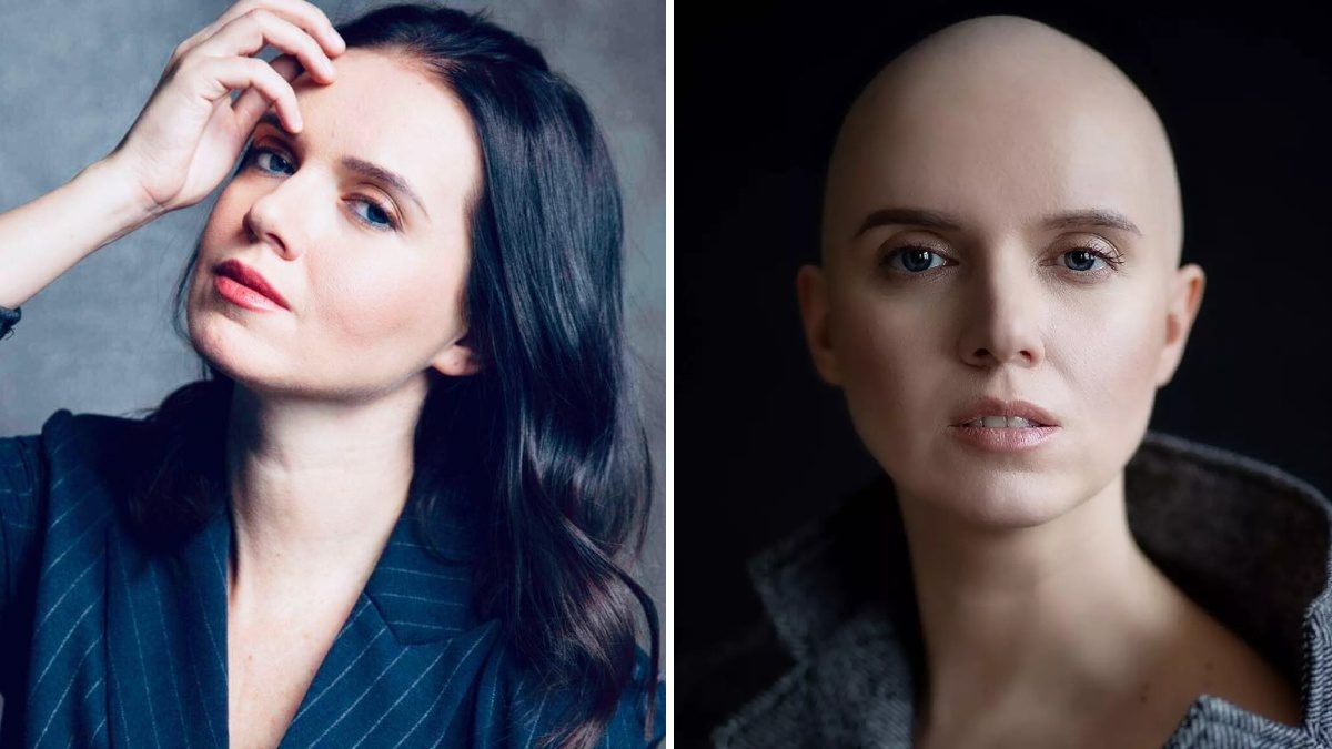 Яніна Соколова до та після раку