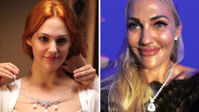 Пластика Мер'єм Узерлі Пластика Мер'єм Узерлі