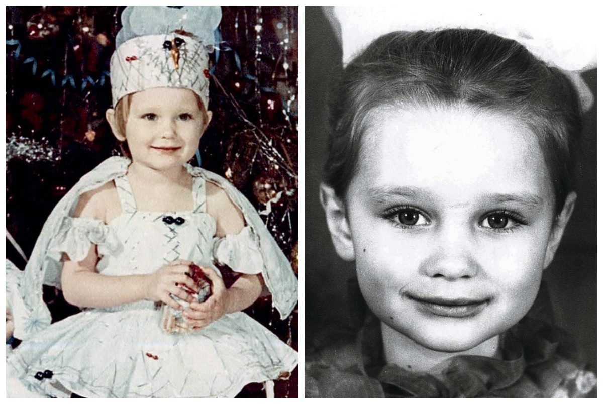 Маленька Лідія Таран – зліва ще без шраму, справа вже з ним