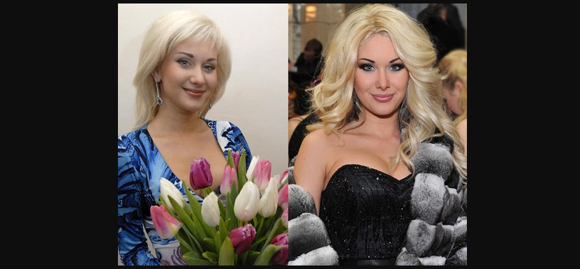 Катя Бужинська до та після ринопластики