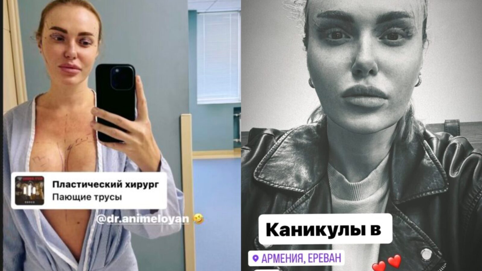 Слава Камінська розповіла, які пластичні операції робила. Фото з Instagram @babaslavka