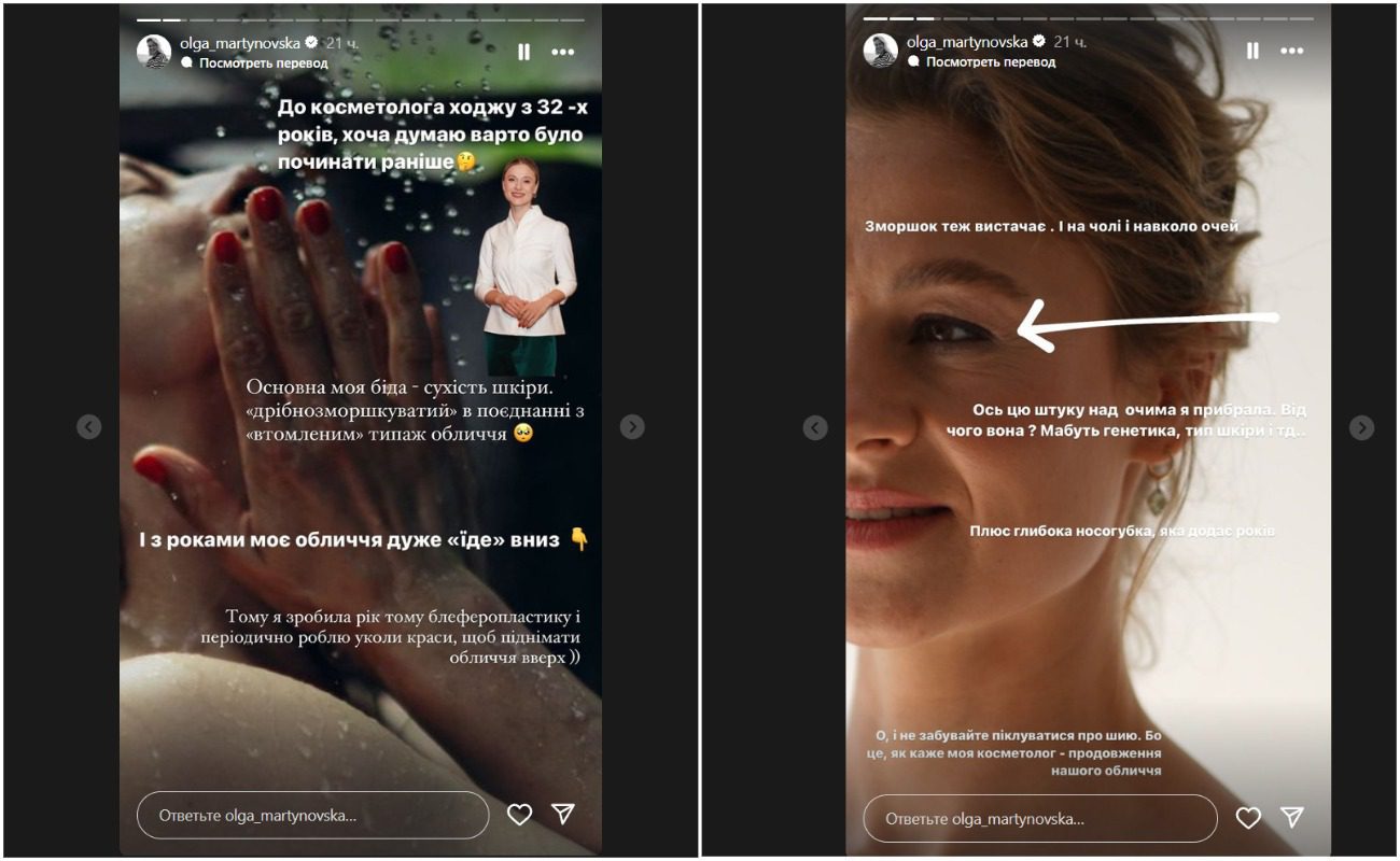 Мартиновська зізналася, що її зовнішність перероблена спеціалістами