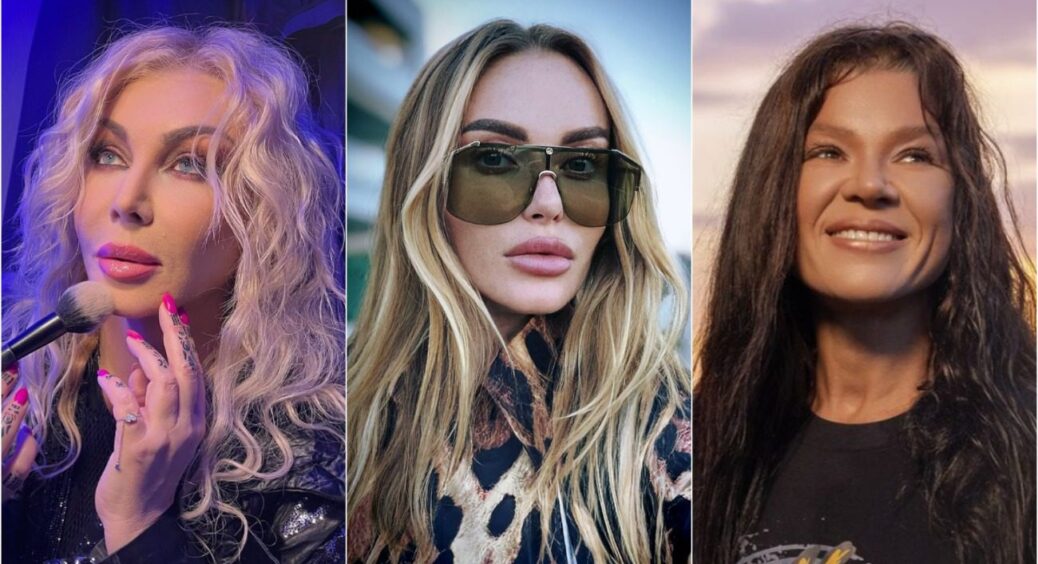 Пластичні хірурги попрацювали “на славу”: зірки до і після пластики – Ірина Білик, Слава Камінська, Руслана 