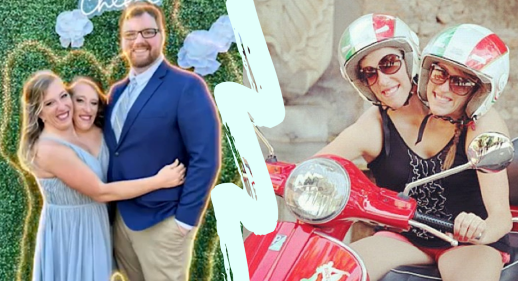 “Це дивно?”: Сіамські близнючки розповіли про свою долю, після того, як одна з них вийшла заміж 