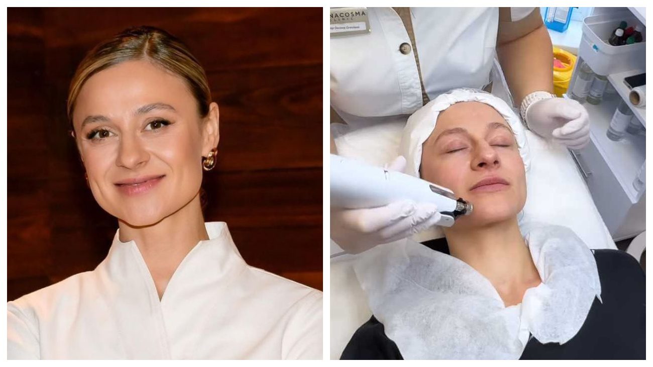 Ольга Мартиновська показала незвичайну косметологічну процедуру для омолодження