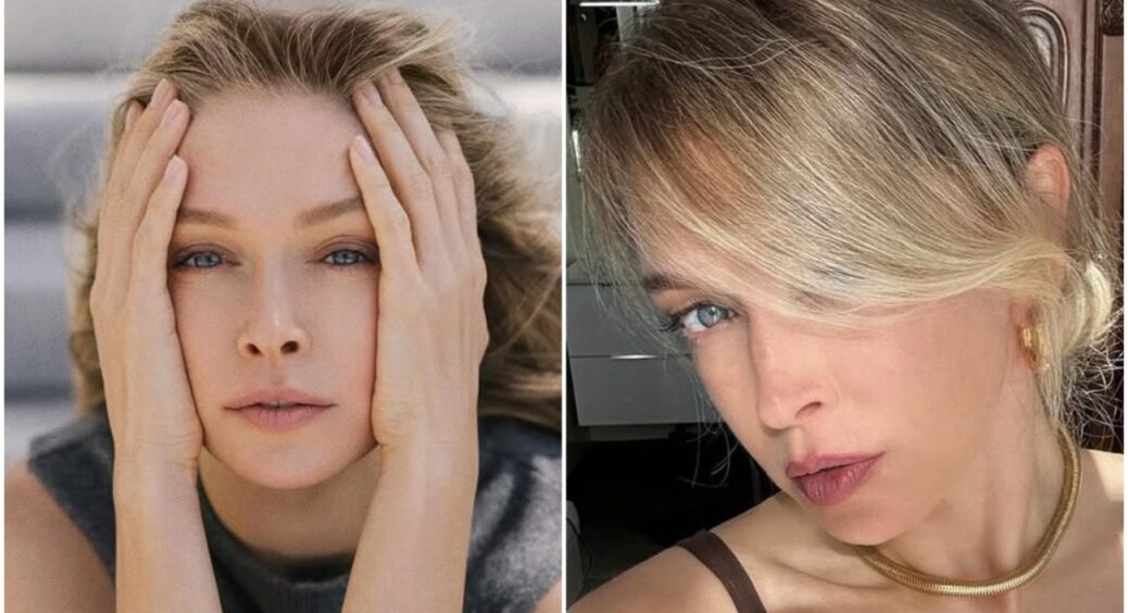 Не ті, що всі думали: які пластичні операції насправді зробила Віра Брежнєва – висновки експерта 