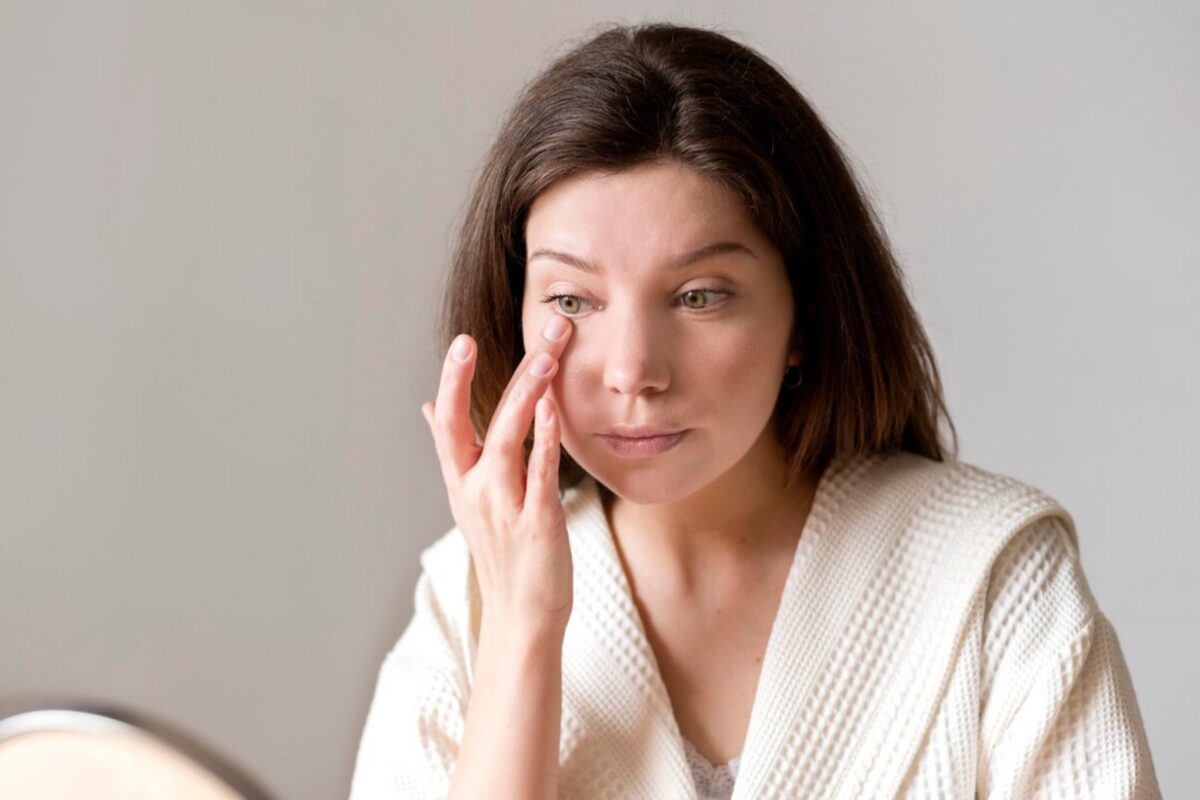 Експерти розповіли, як позбутись темних кіл під очима