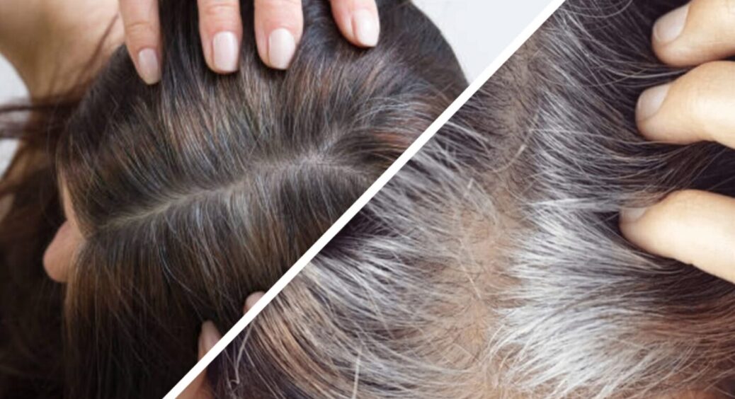 Сиве волосся зникне раз і назавжди: бабусі вірять і говорять, що це дійсно працює 