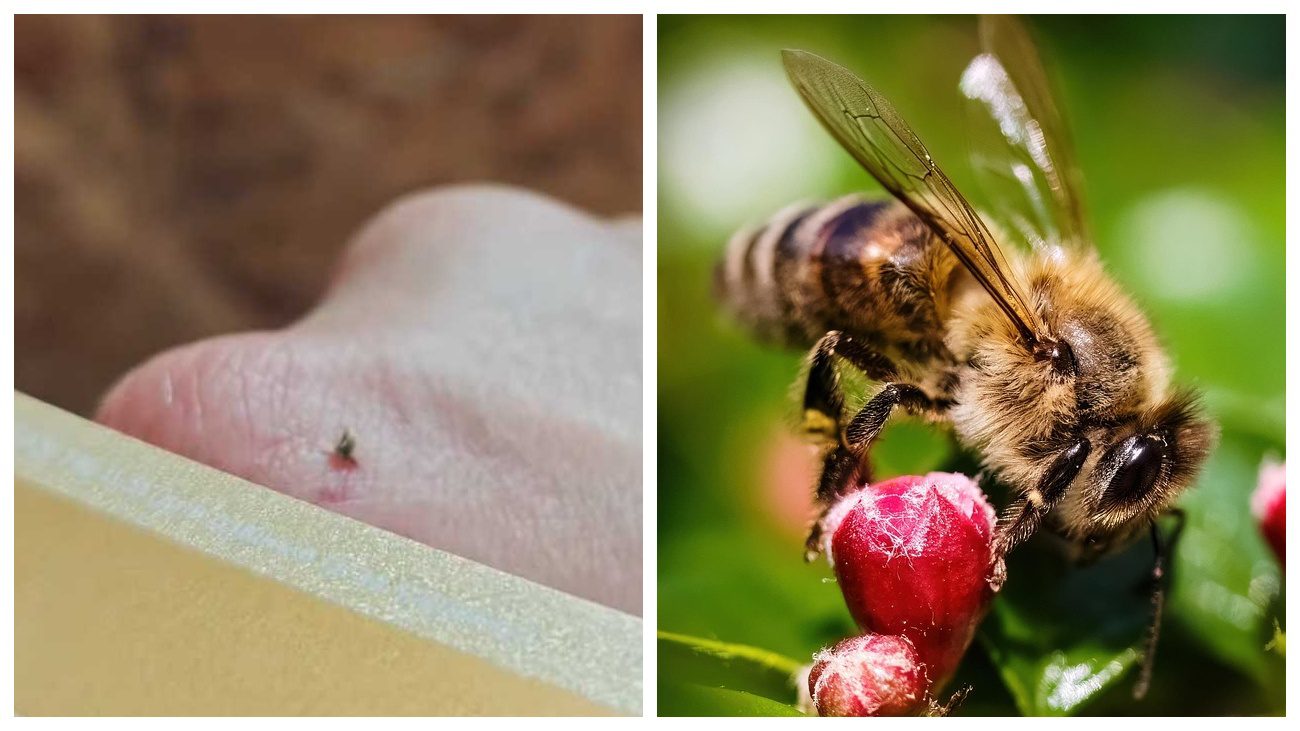 Українка показала, як банківською картою витягнути жало бджоли