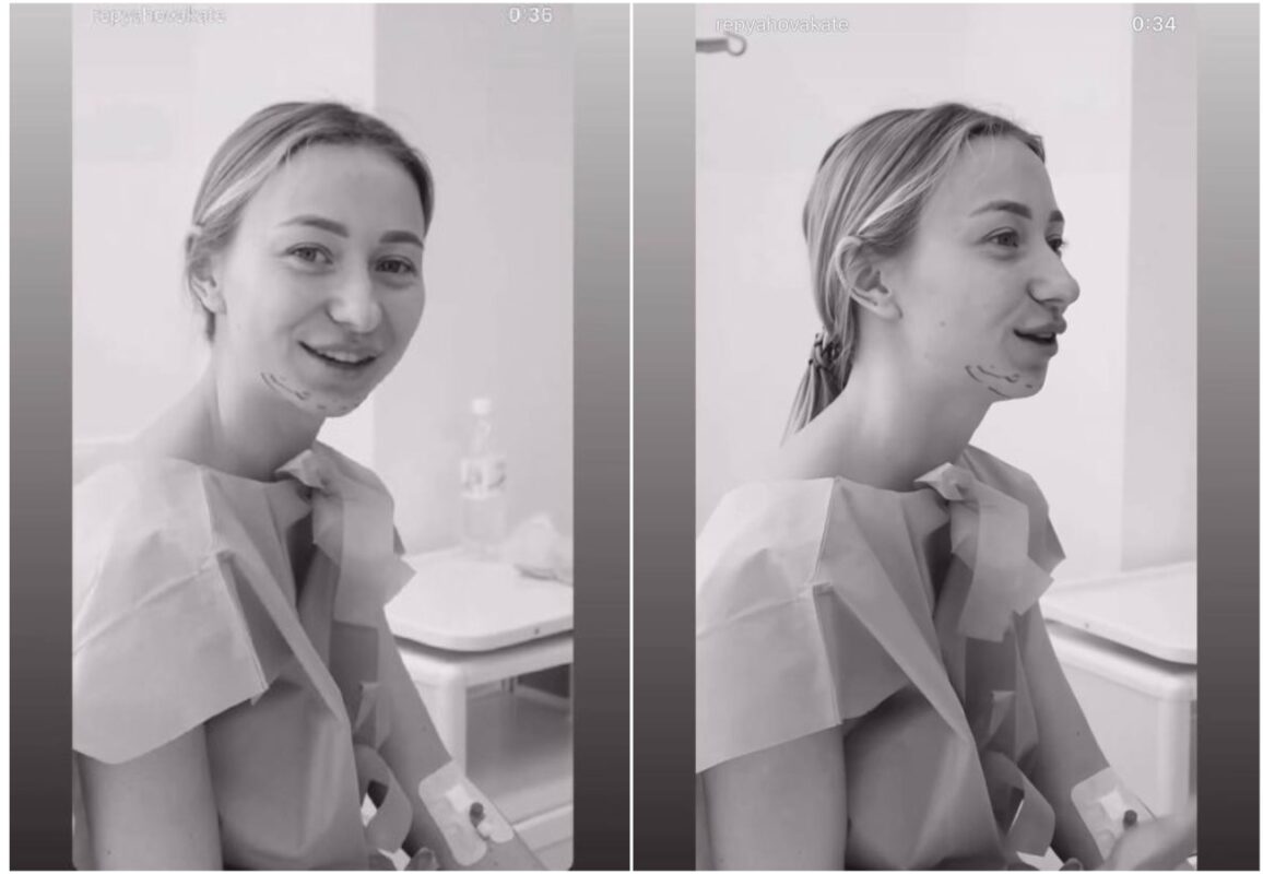 Так виглядала дружина Віктора Павлика до всіх пластичних операцій