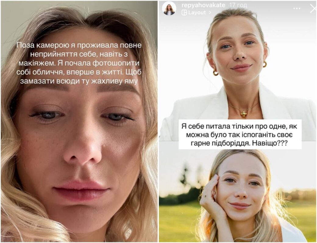 Дружина Віктора Павліка зізналася, що перестаралася із пластикою