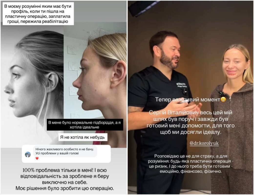 Дружина Віктора Павліка зізналася, що перестаралася із пластикою