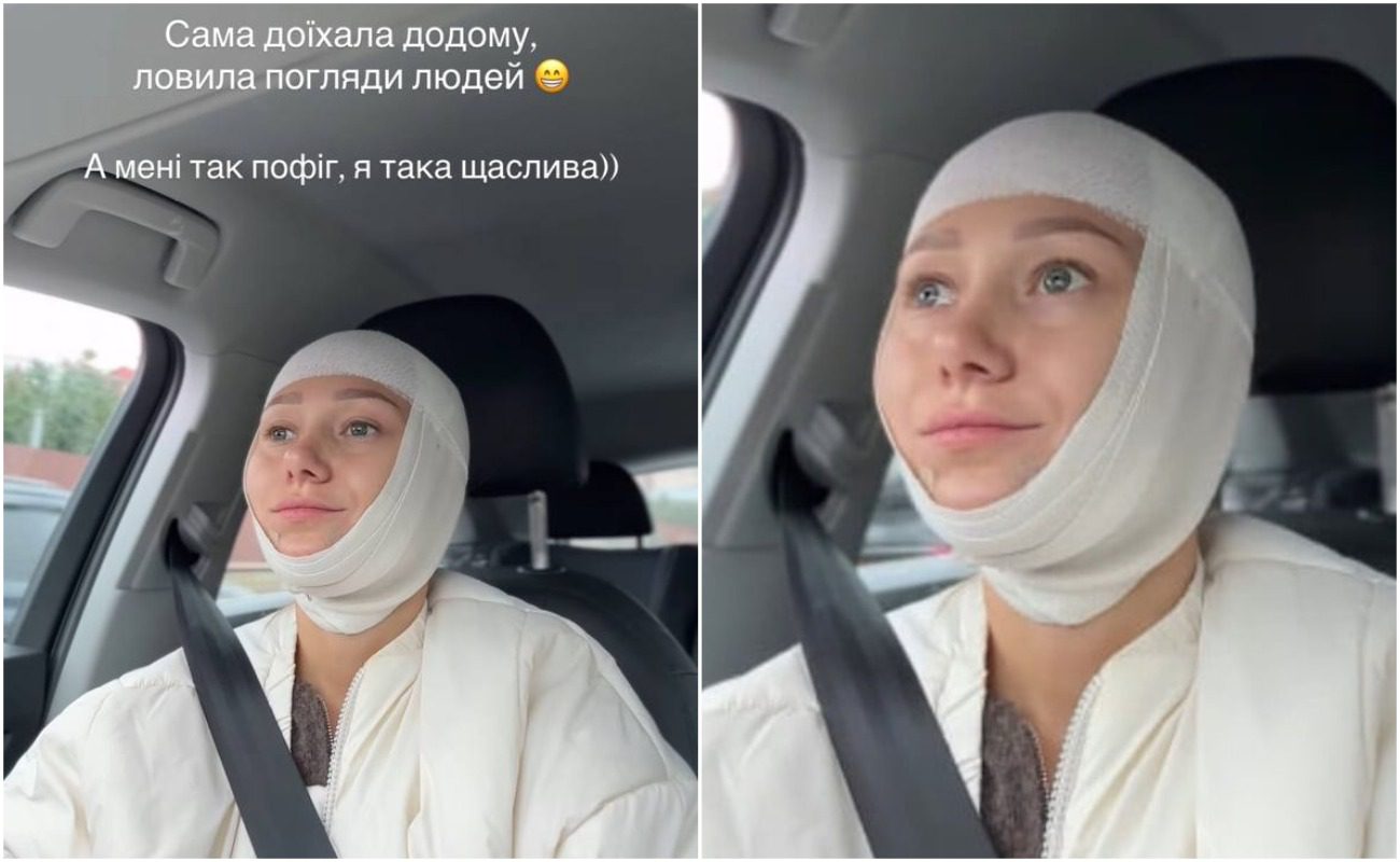 Катерина Репяхова показала, як виглядає після 4-ї пластики