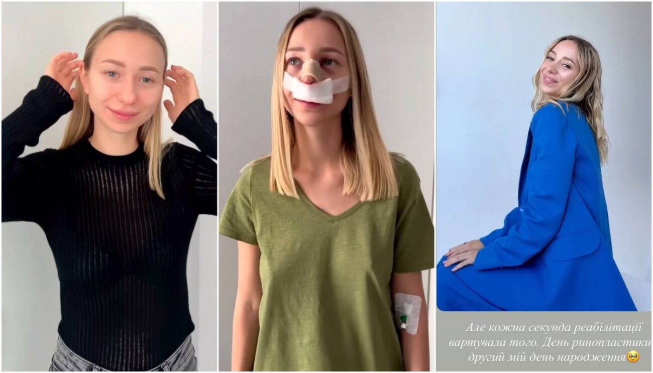 Катерина Репяхова показала, як виглядає після 4-ї пластики