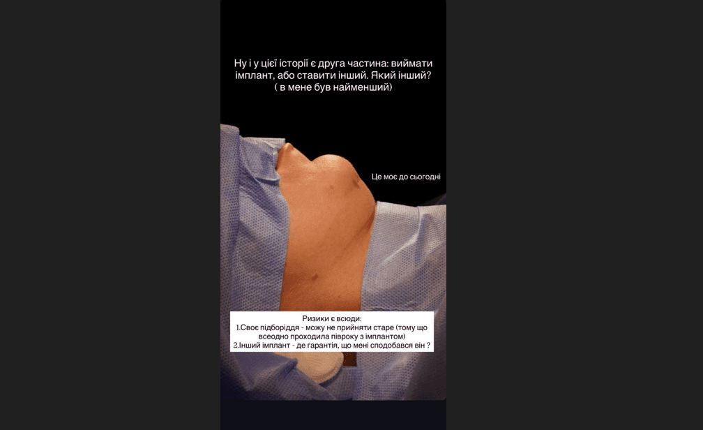 Дружина Віктора Павліка зізналася, що перестаралася із пластикою