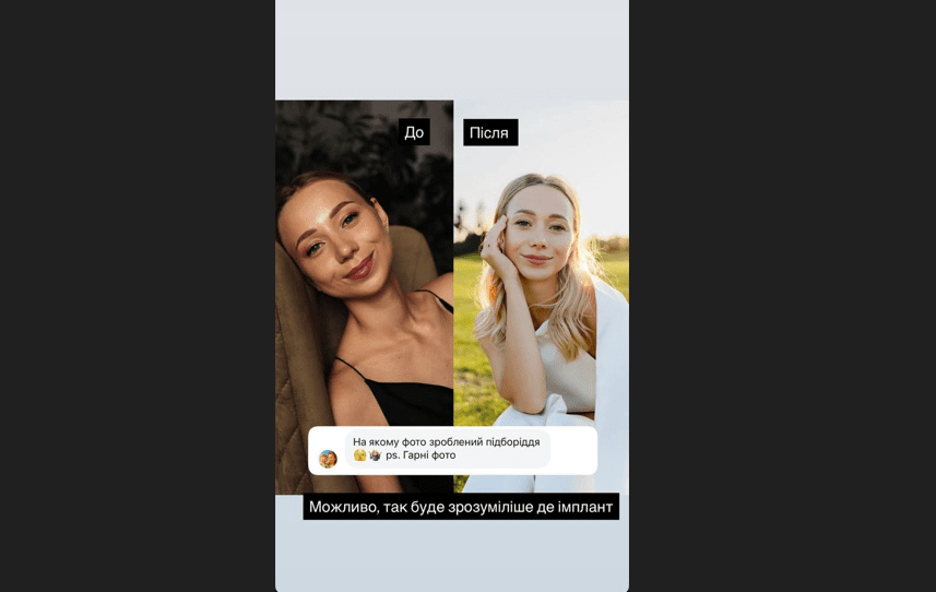 Дружина Віктора Павліка зізналася, що перестаралася із пластикою