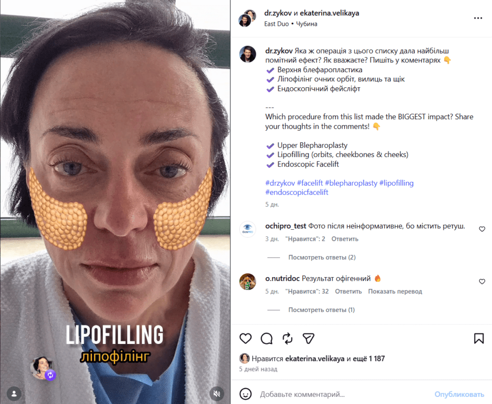 Причому в Інстаграмі Велика навіть оприлюднила відео, на якому було знято перші хвилини в операційній.