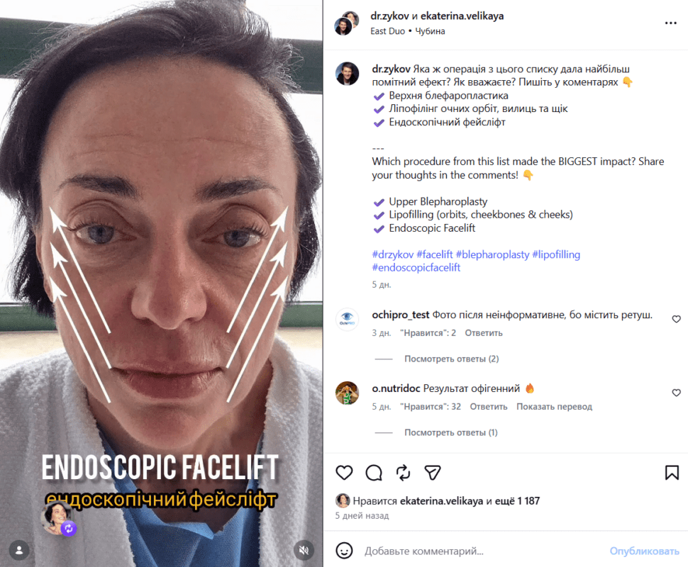 Причому в Інстаграмі Велика навіть оприлюднила відео, на якому було знято перші хвилини в операційній.